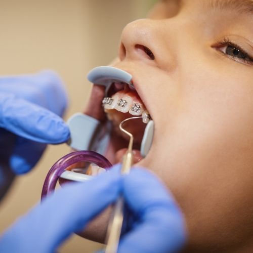 dentista revisa la ortodoncia