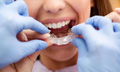 ortodoncia en arganda y azuqueca