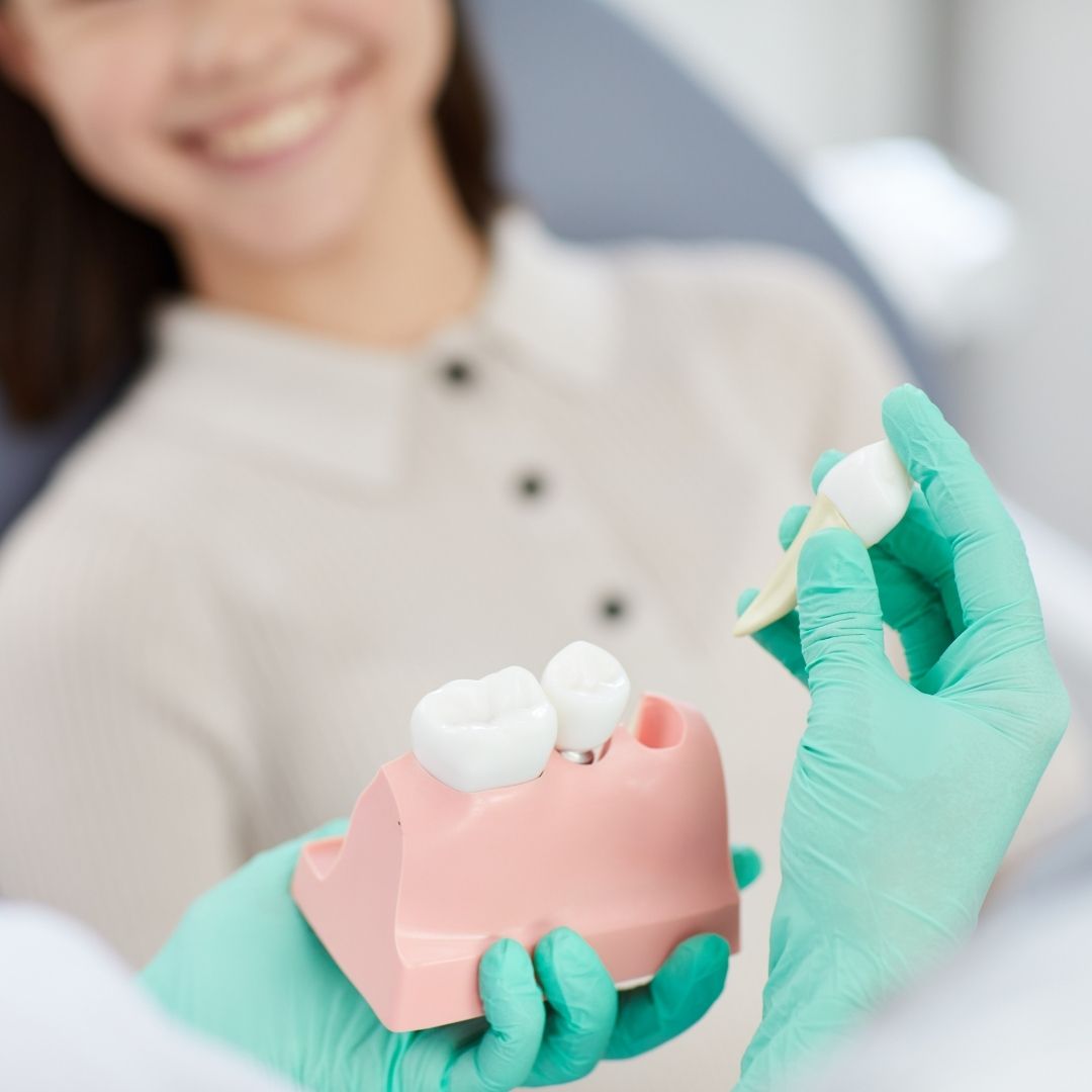 Tipos de implantes dentales ¿Implantes de carga inmediata?